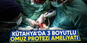 Kütahya’da 3 boyutlu yazıcıyla üretildi başarıyla uygulandı