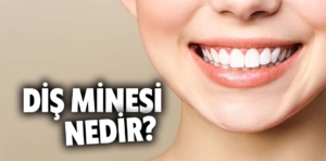 Diş Minesi Nedir? Diş Minesi Aşınması ve Tedavi Yöntemleri