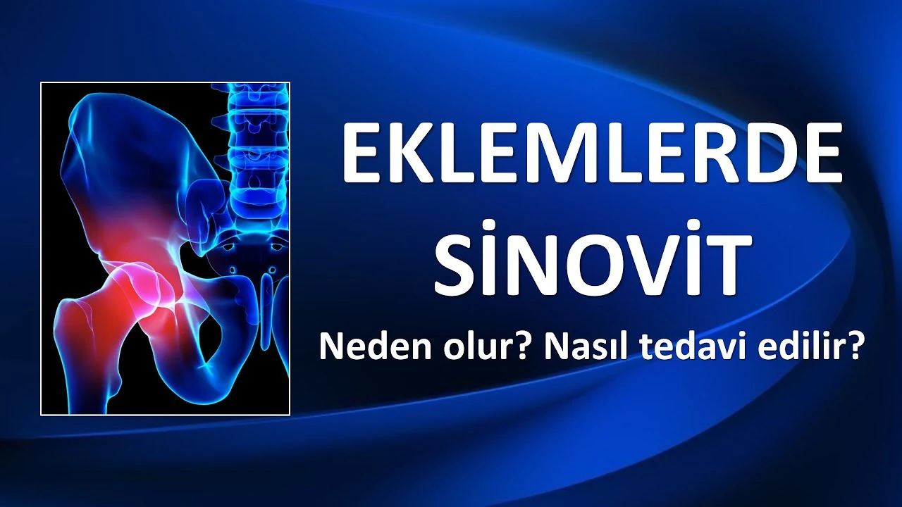 Sinovit Nedir ve Belirtileri Nelerdir?