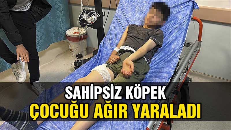 Sivas'ta sahipsiz köpeğin saldırısına