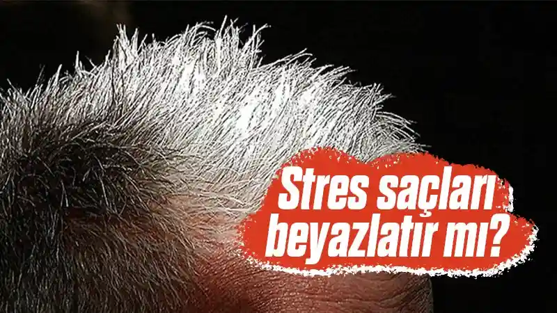 Stres saçları beyazlatır mı?