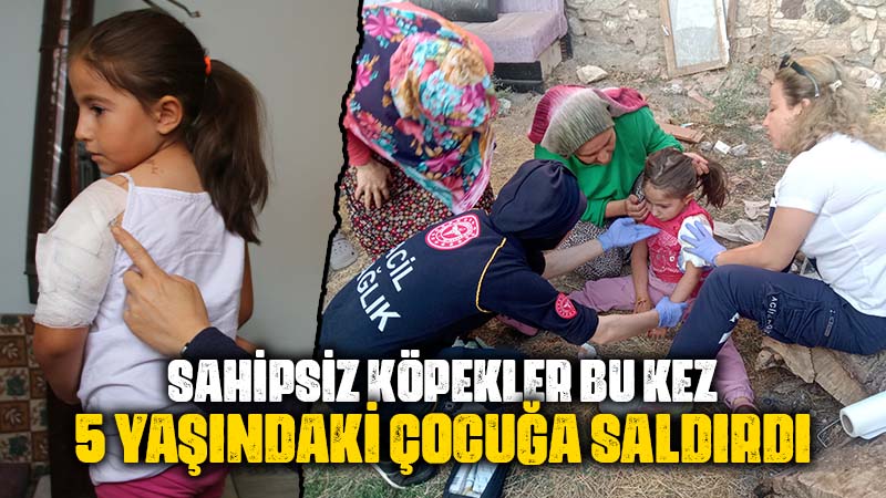 Kütahya’da sahipsiz köpekler küçük çocuğa saldırdı 